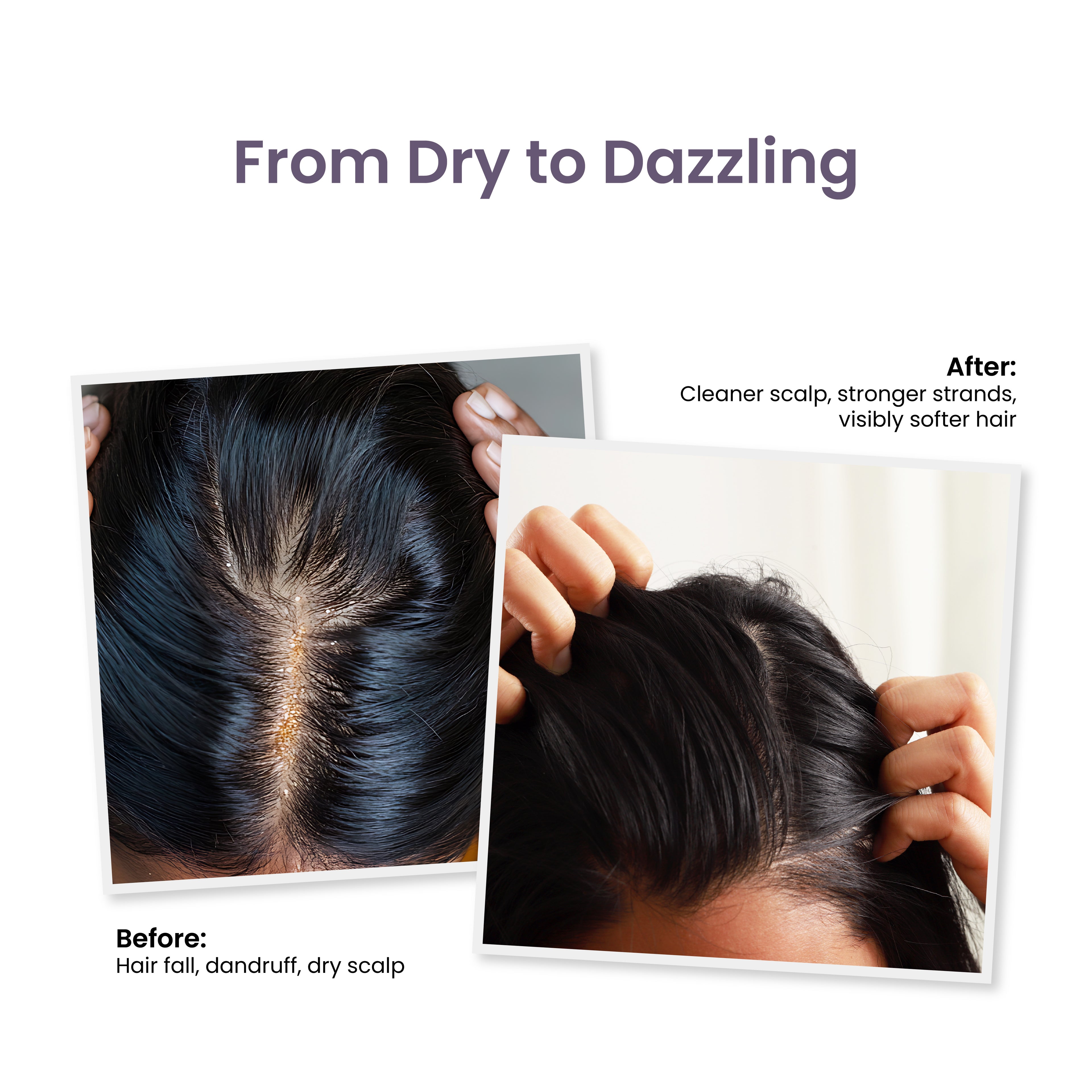 Trycone Rosemary Hair Shampoo Enriched with Hydrolyzed Wheat Protein & Natural Actives β 200 Ml