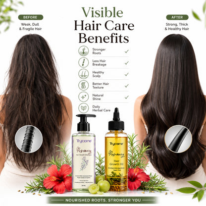 Rosemary Hair Growth Combo – Hair Oil 200ml + Shampoo 200ml | Controls Hair Fall, Strengthens Roots &amp; Promotes Hair Growth | 2-Step Hair Care Kit for Men and Women