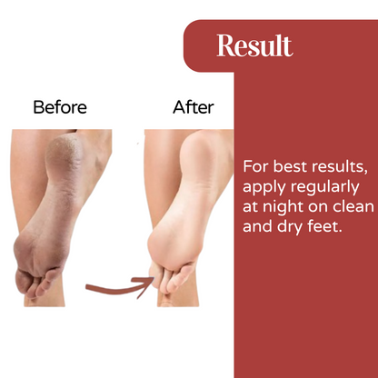 Cracked Heel Repair Foot Cream for cracked heels - 100 g