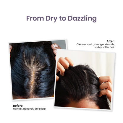 Trycone Rosemary Hair Shampoo Enriched with Hydrolyzed Wheat Protein &amp; Natural Actives – 200 Ml